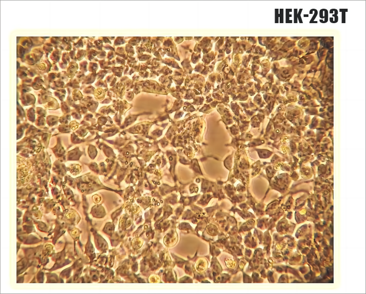 在<i style='color:red'>hek293</i>細(xì)胞系中表達(dá)蛋白的方法步驟和經(jīng)驗分享